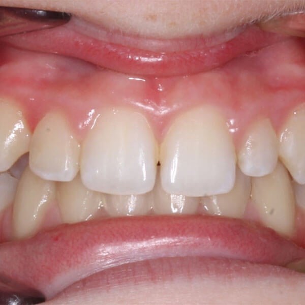 Before