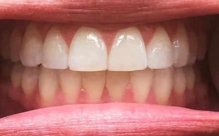 Smile Image