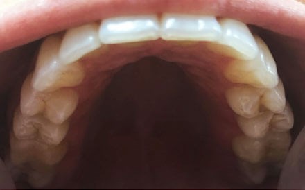 Smile Image
